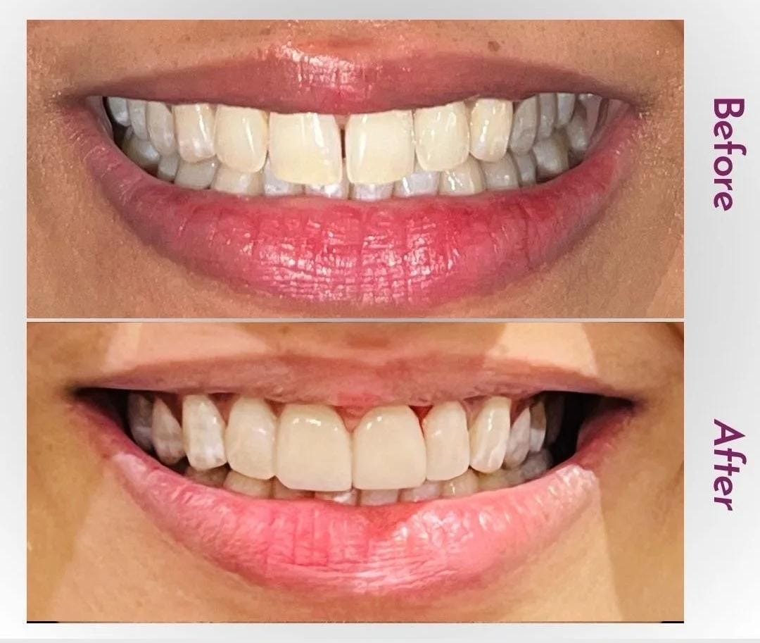 08ae15a8 64e1 4059 a142 d64293f5bd41