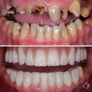 Home 14d9c9b9475da34da47b3decabf37abd