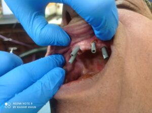 Home 8fa1c1e1 65d9 4089 948a e651140bcc14